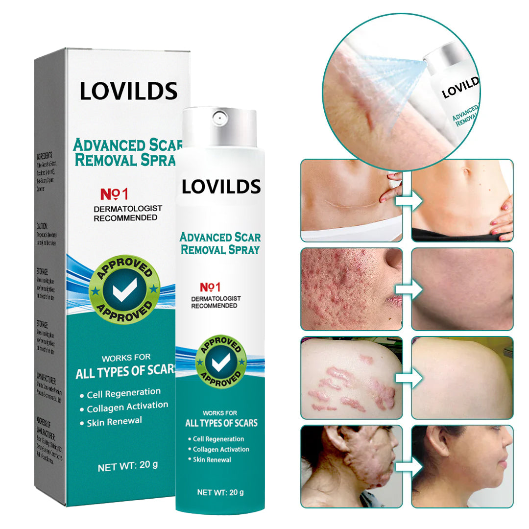 (🔥ULTIMO GIORNO DI SALDI-70% DI SCONTO) LOVILDS™ Spray Avanzato per Rimozione Cicatrici