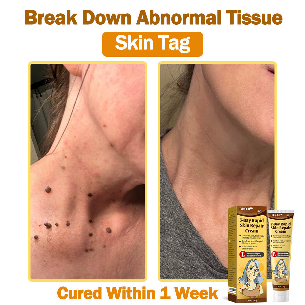 BBOJI™ 𝟕-Tage Schnelle Hautreparaturcreme US-Dermatologen-zugelassen (🏆🔥AAD EMPFIEHLT)