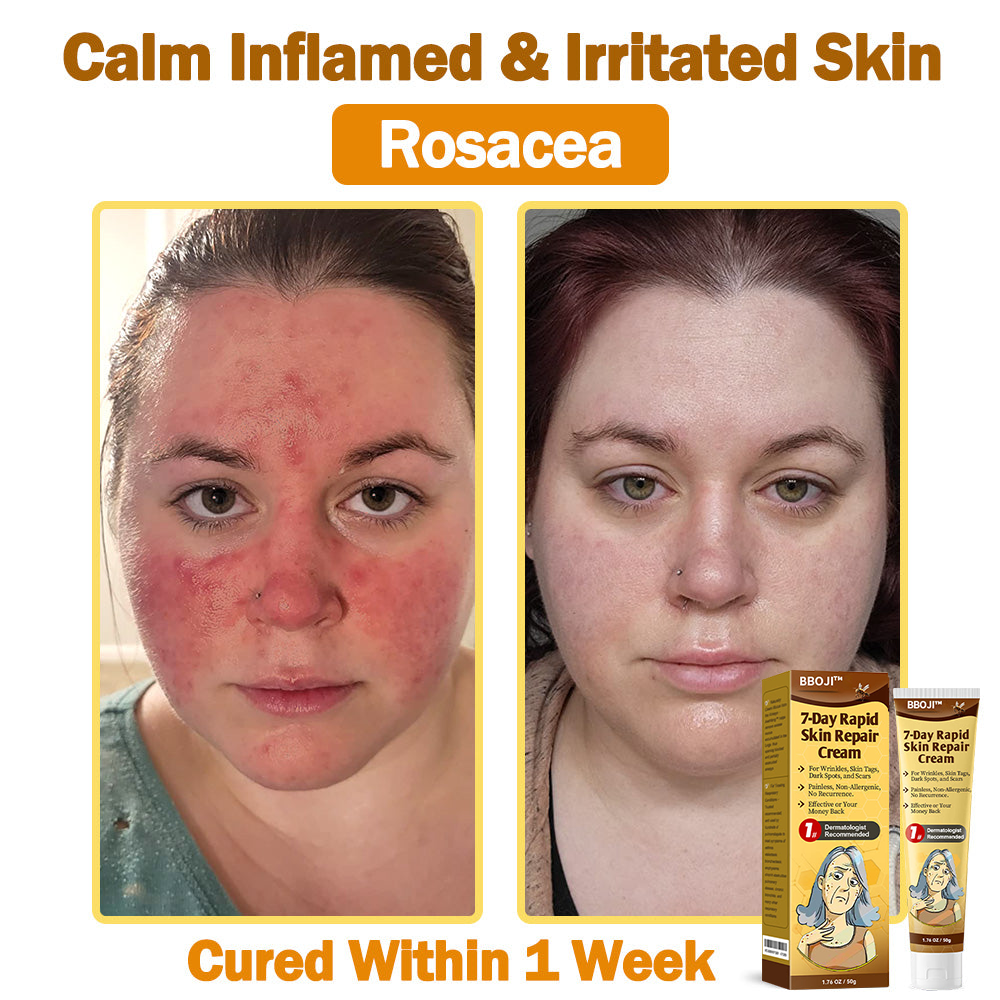 BBOJI™ 𝟕-Tage Schnelle Hautreparaturcreme US-Dermatologen-zugelassen (🏆🔥AAD EMPFIEHLT)