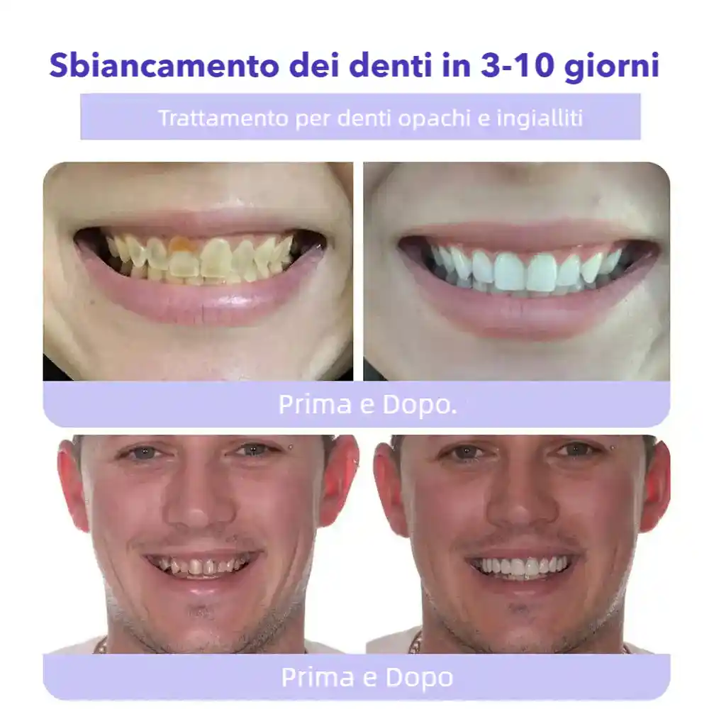 BBOJI™ Polvere Minerale per il Ripristino dei Denti🦷(raccomandata dall'ADA)
