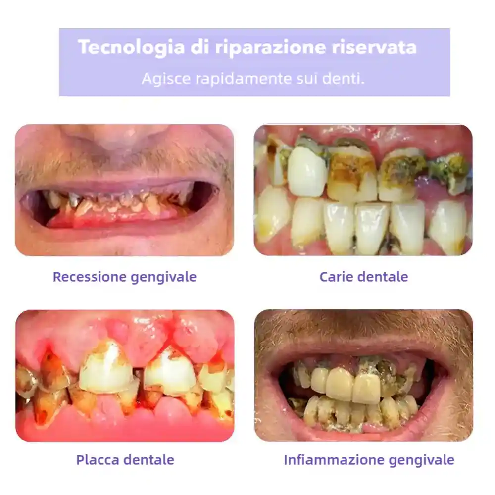 BBOJI™ Polvere Minerale per il Ripristino dei Denti🦷(raccomandata dall'ADA)