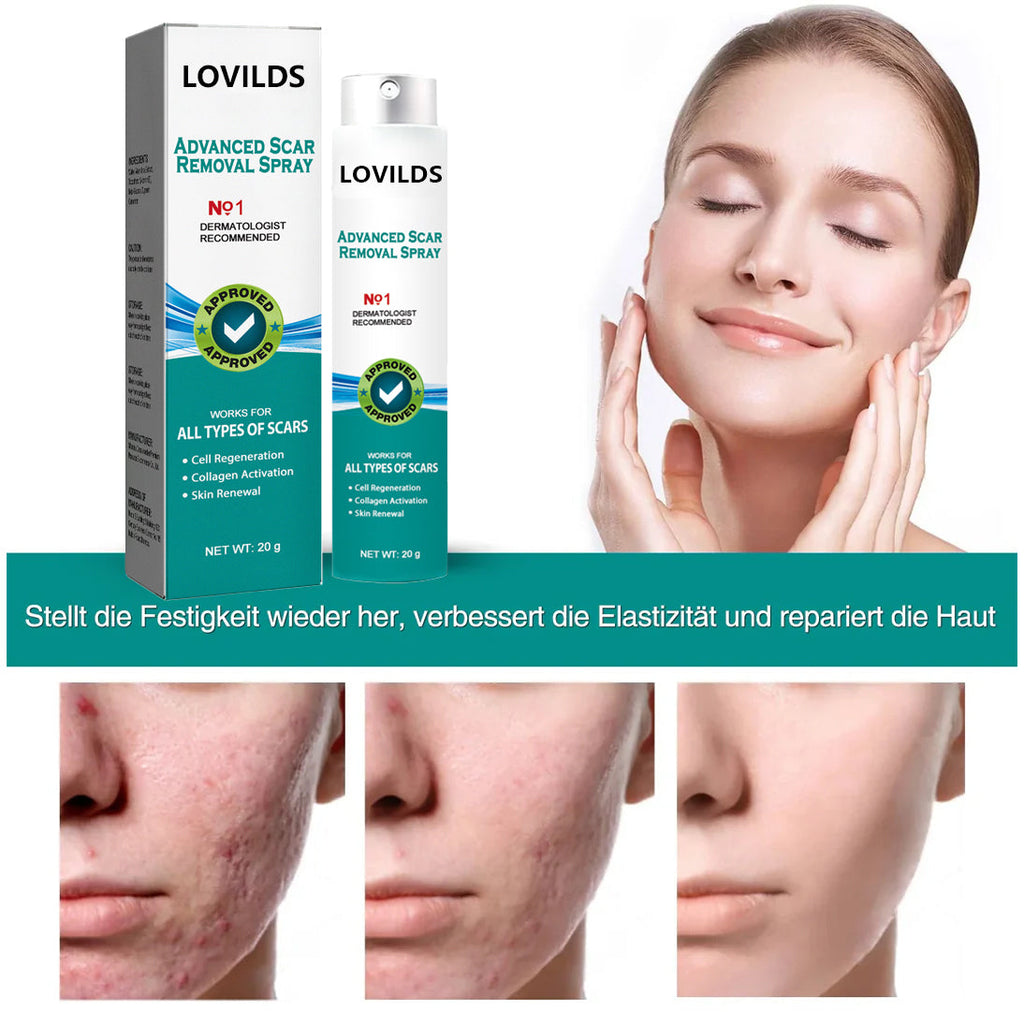 (🔥LETZTER TAG VERKAUF-70% RABATT) LOVILDS™ Fortgeschrittenes Narbenentfernungs-Spray