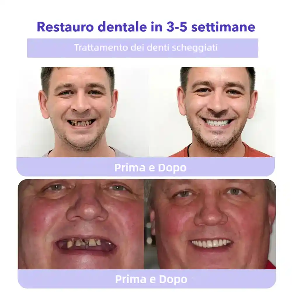 BBOJI™ Polvere Minerale per il Ripristino dei Denti🦷(raccomandata dall'ADA)
