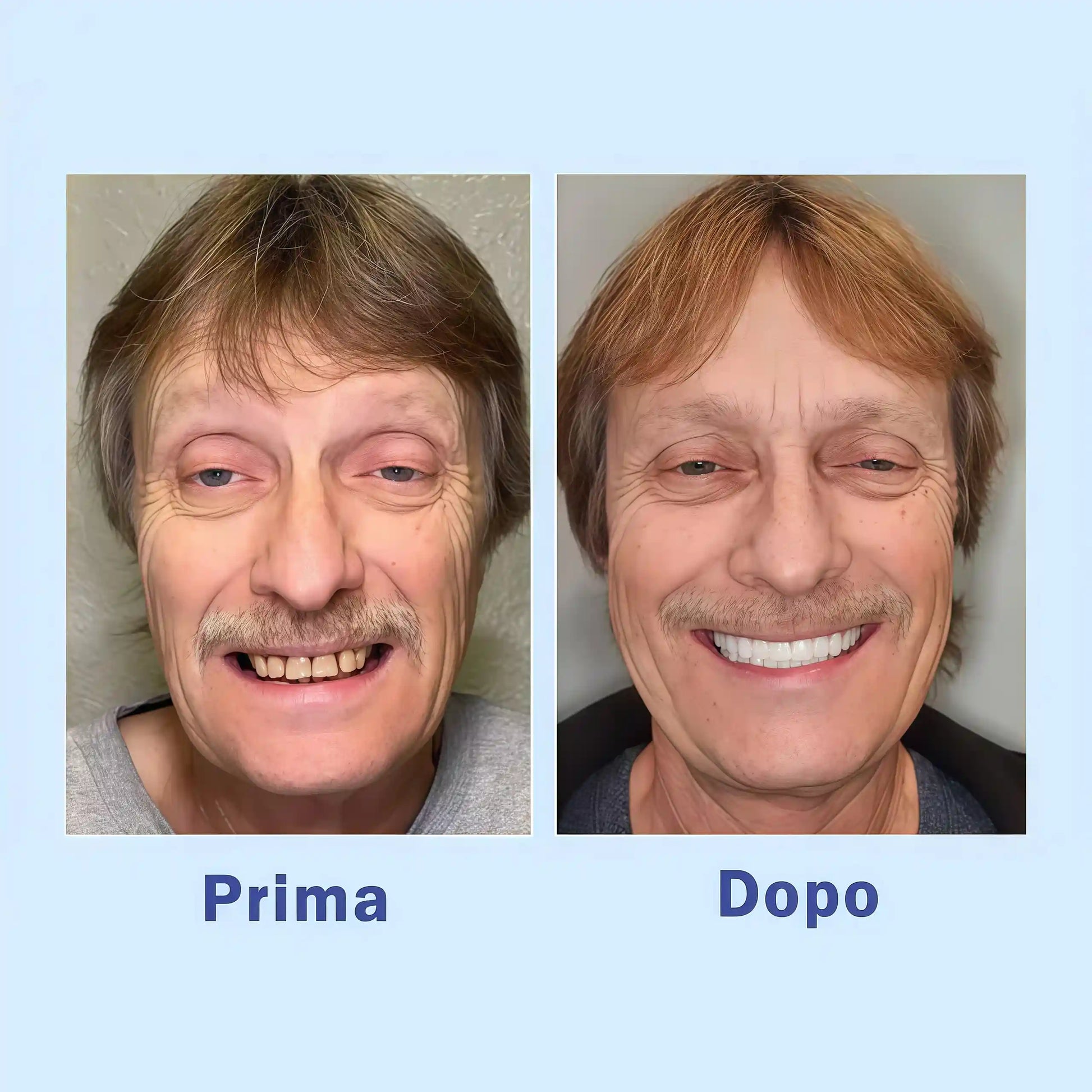 Venesh™ Protesi Dentaria di Alta Qualità 💎 – Acquista Ora Prima che Esaurita! ⏳🔥