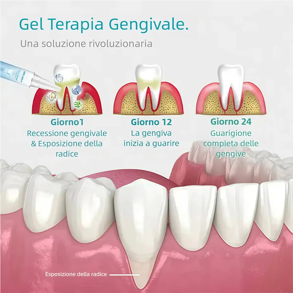 🔥Promozione ultimo giorno 80% di sconto - Gel terapeutico per paradenti NESLEMY™