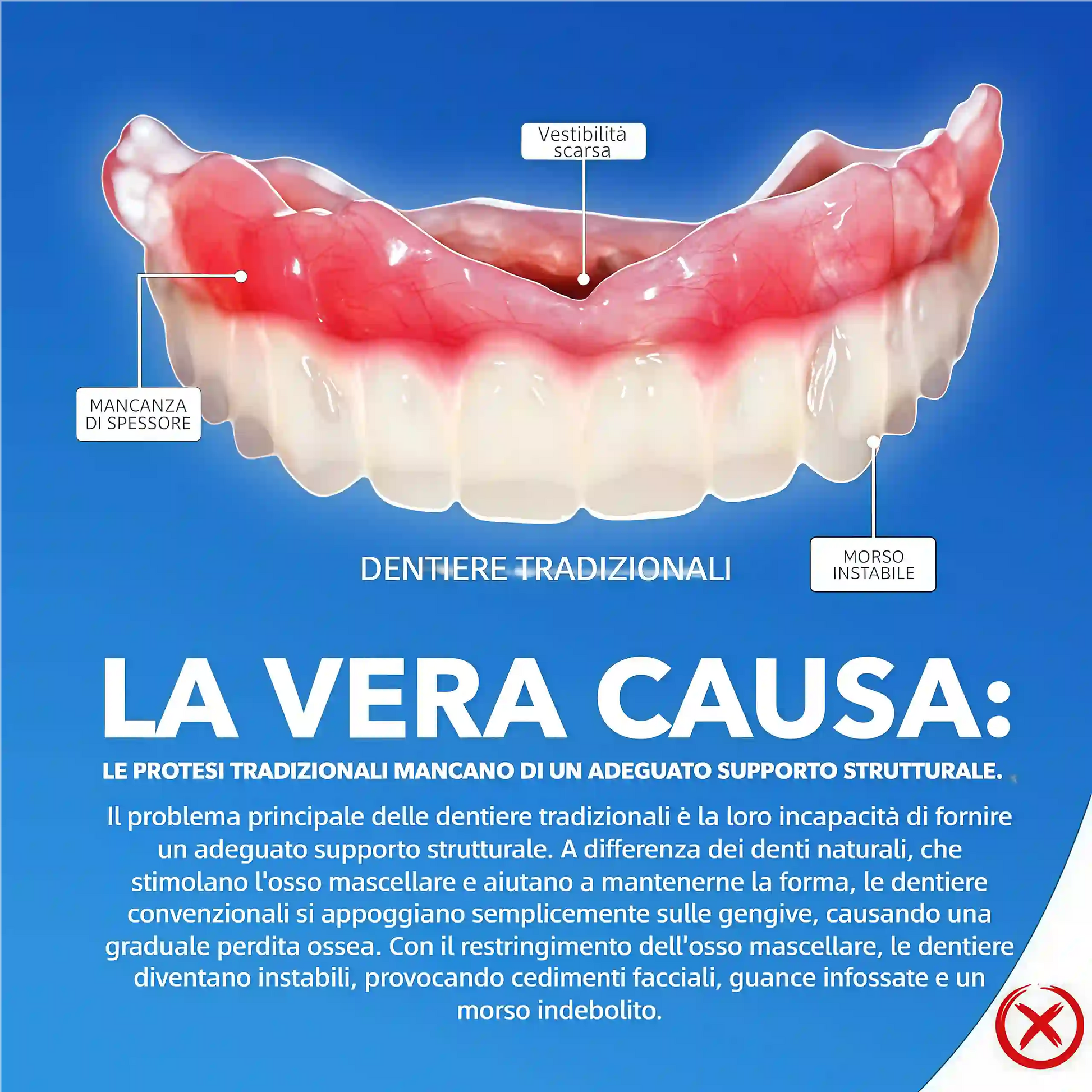Venesh™ - Set Completo di Protesi Dentarie Premium