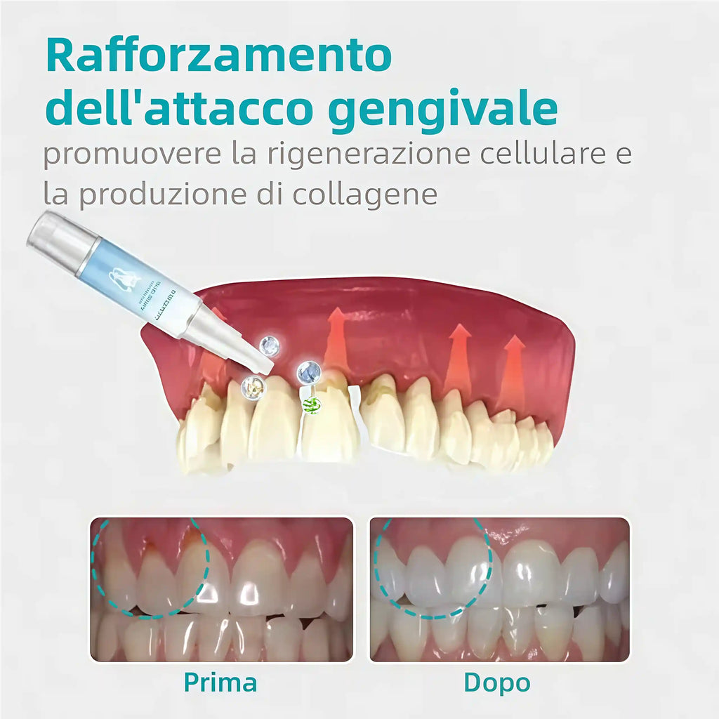 🔥Promozione ultimo giorno 80% di sconto - Gel terapeutico per paradenti NESLEMY™
