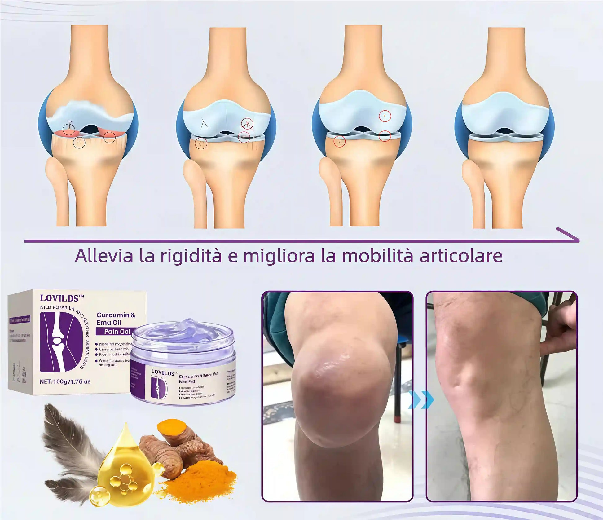 LOVILDS™ Gel al Olio di Emù e Curcumina per il Dolore – 🏥Sviluppato con il Supporto di Esperti Osteopatici Statunitensi