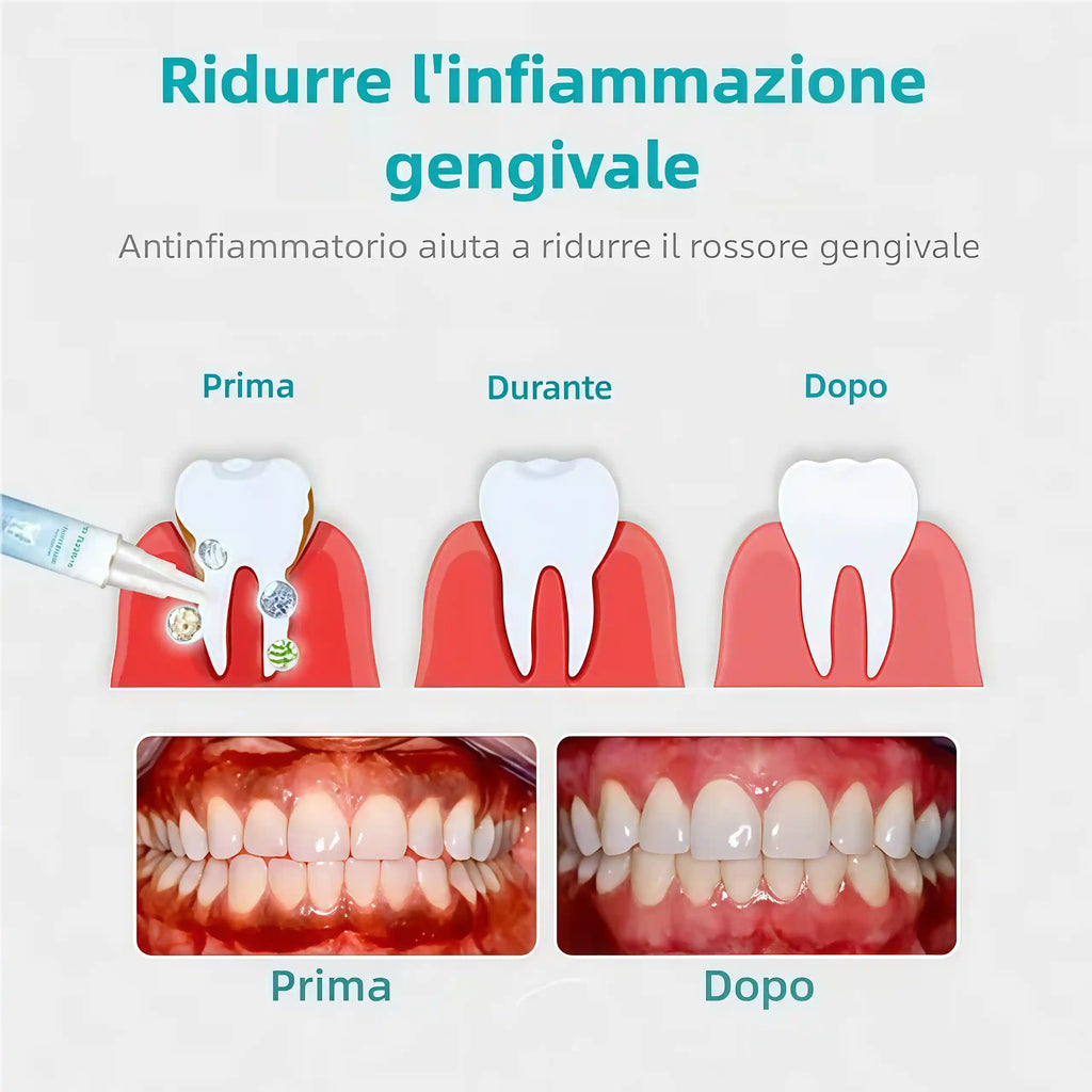 🔥Promozione ultimo giorno 80% di sconto - Gel terapeutico per paradenti NESLEMY™
