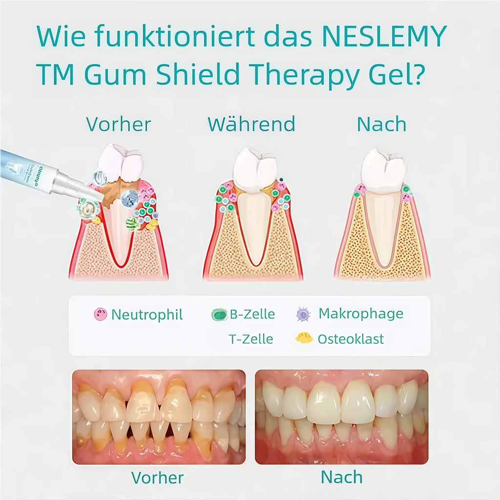 🔥Last Day Promotion 80% OFF-NESLEMY™ Gum Shield Therapy Gel