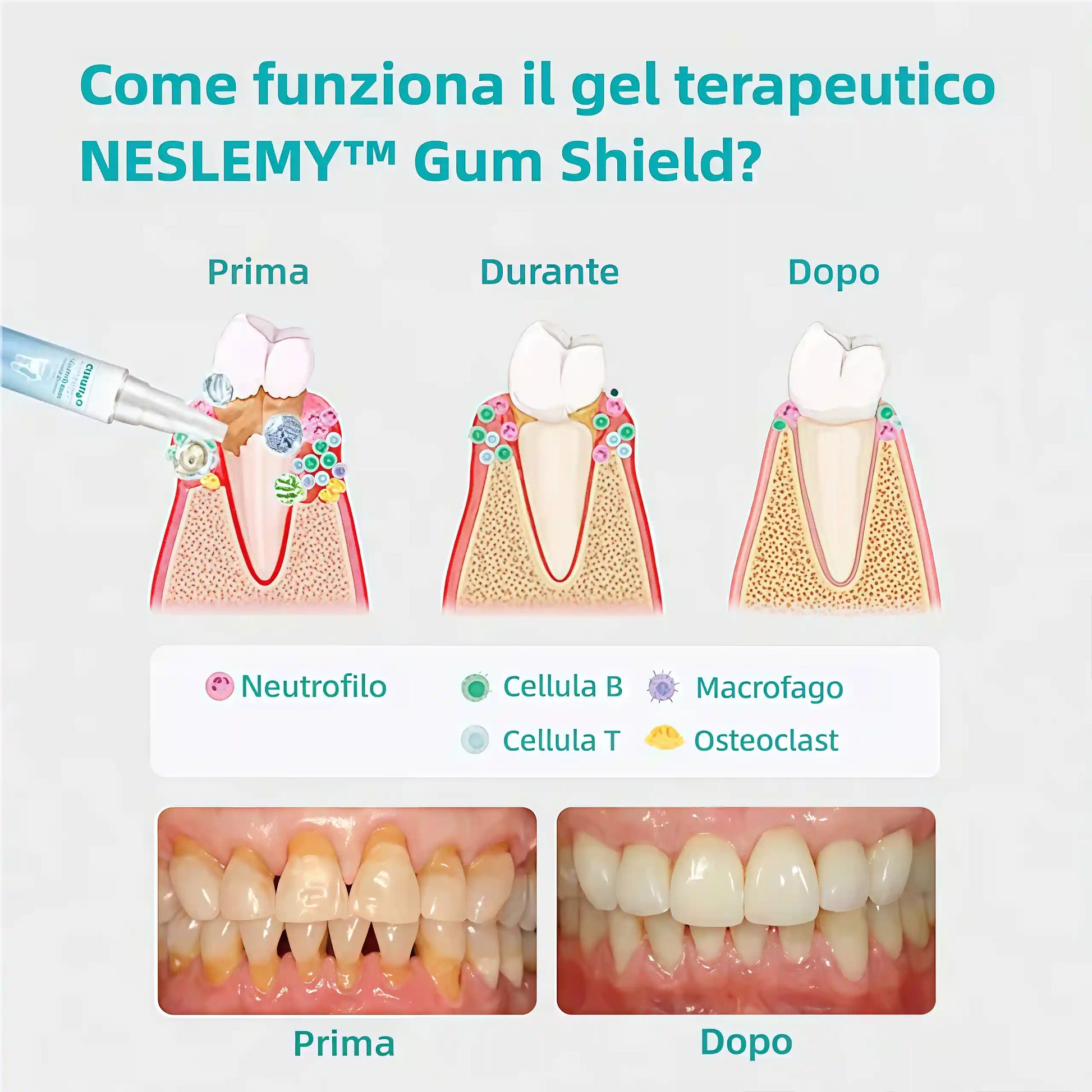 🔥Promozione ultimo giorno 80% di sconto - Gel terapeutico per paradenti NESLEMY™