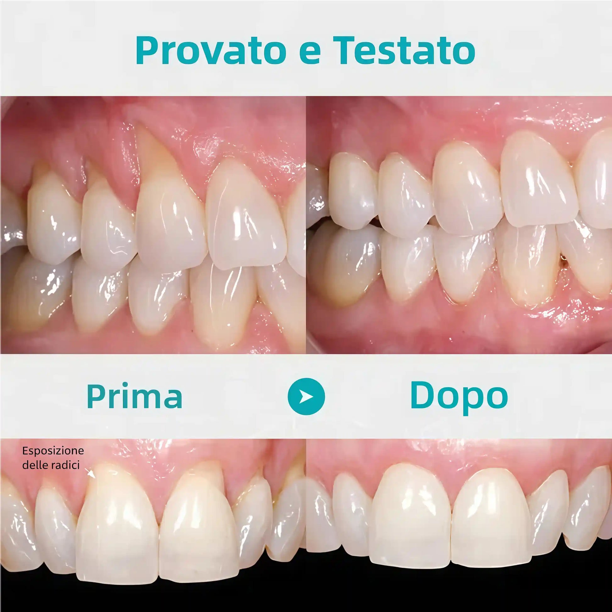🔥Promozione ultimo giorno 80% di sconto - Gel terapeutico per paradenti NESLEMY™