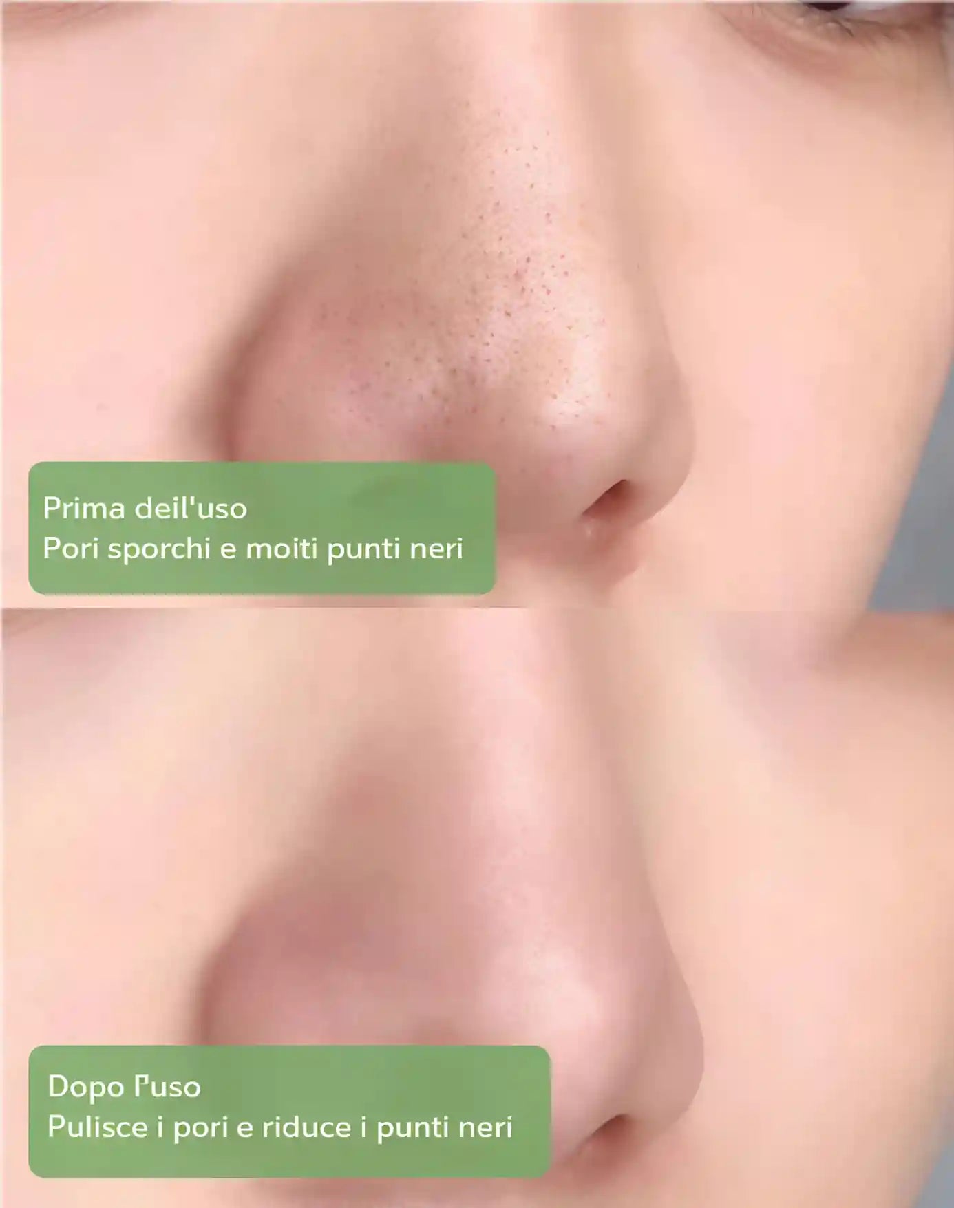 💥Maschera al Tè Verde BBOJI™ per una Pulizia Profonda e Combattimento dei Batteri